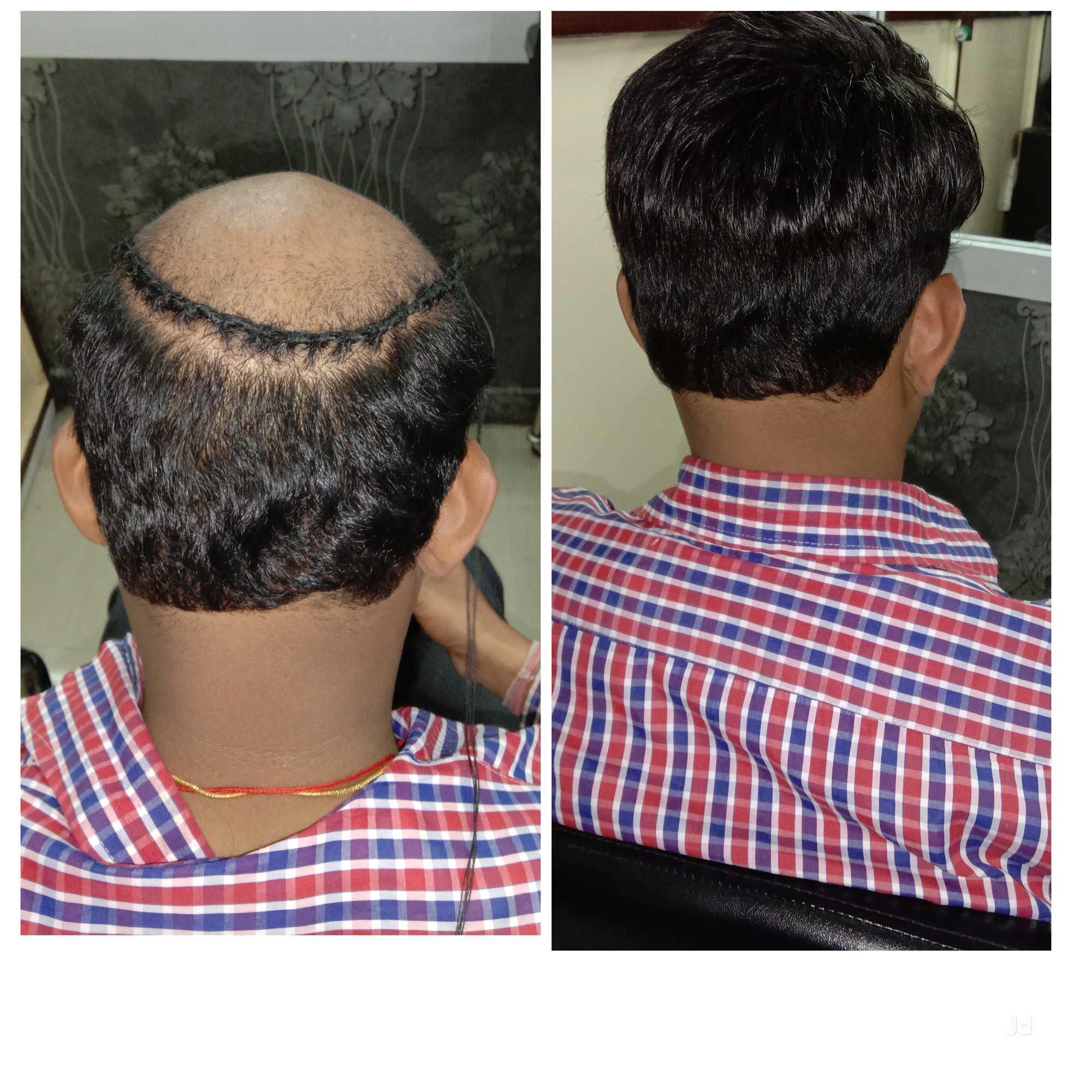 Hair Weaving