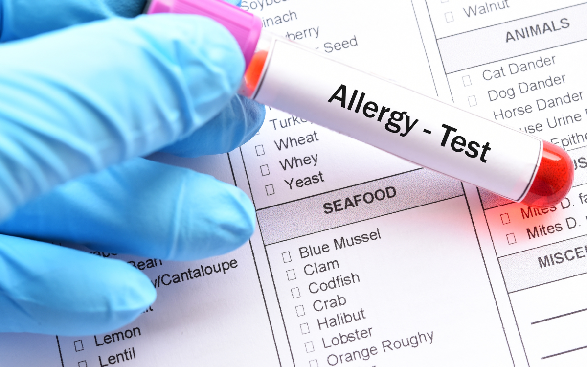 Allergy Testing