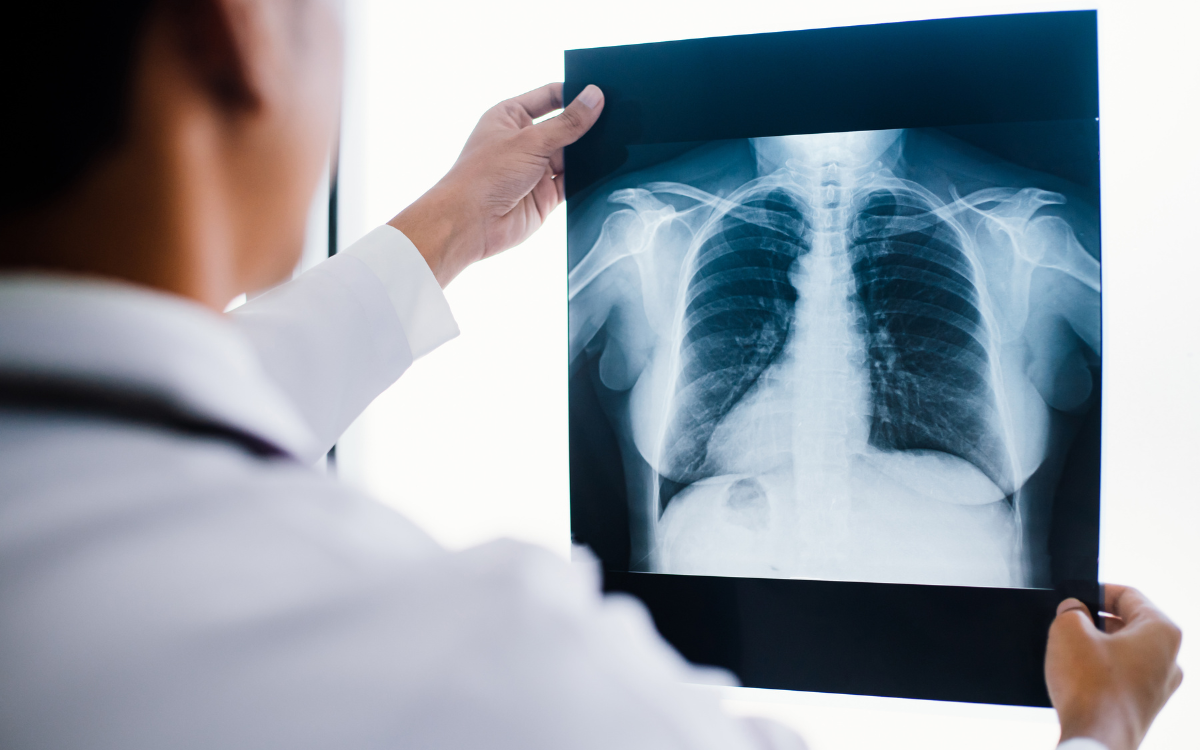 X-Ray